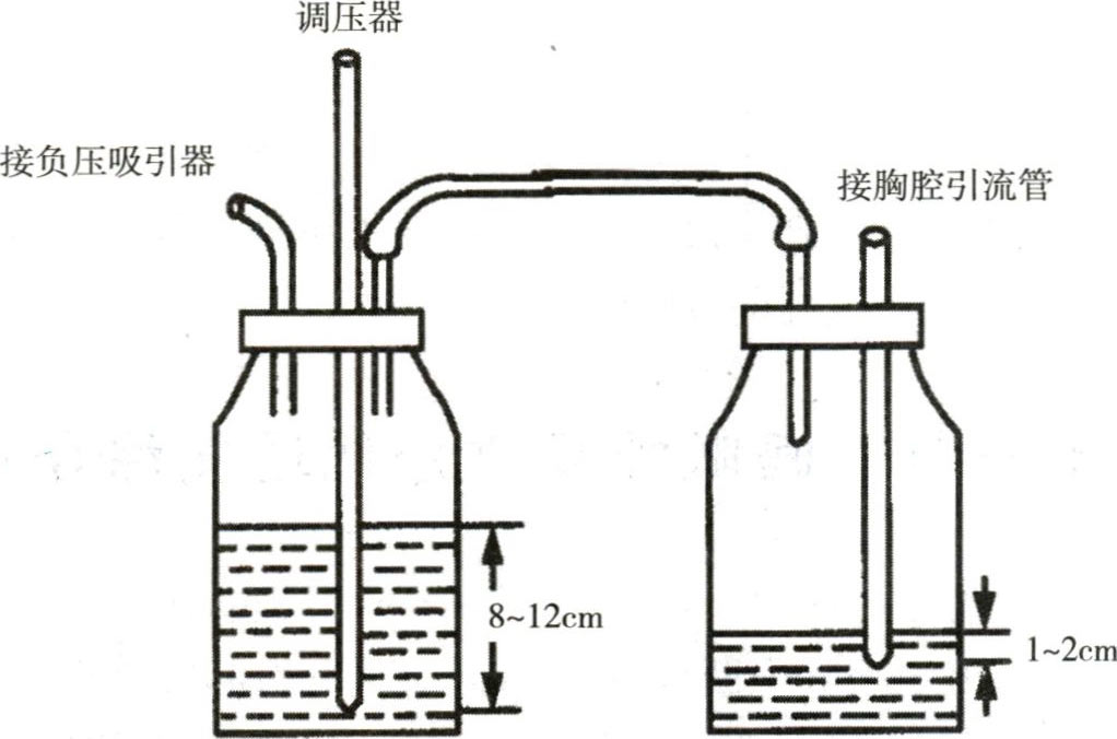 中心负压管道)与压力调节瓶相连,并将调节瓶与单纯负压引流水封瓶连接