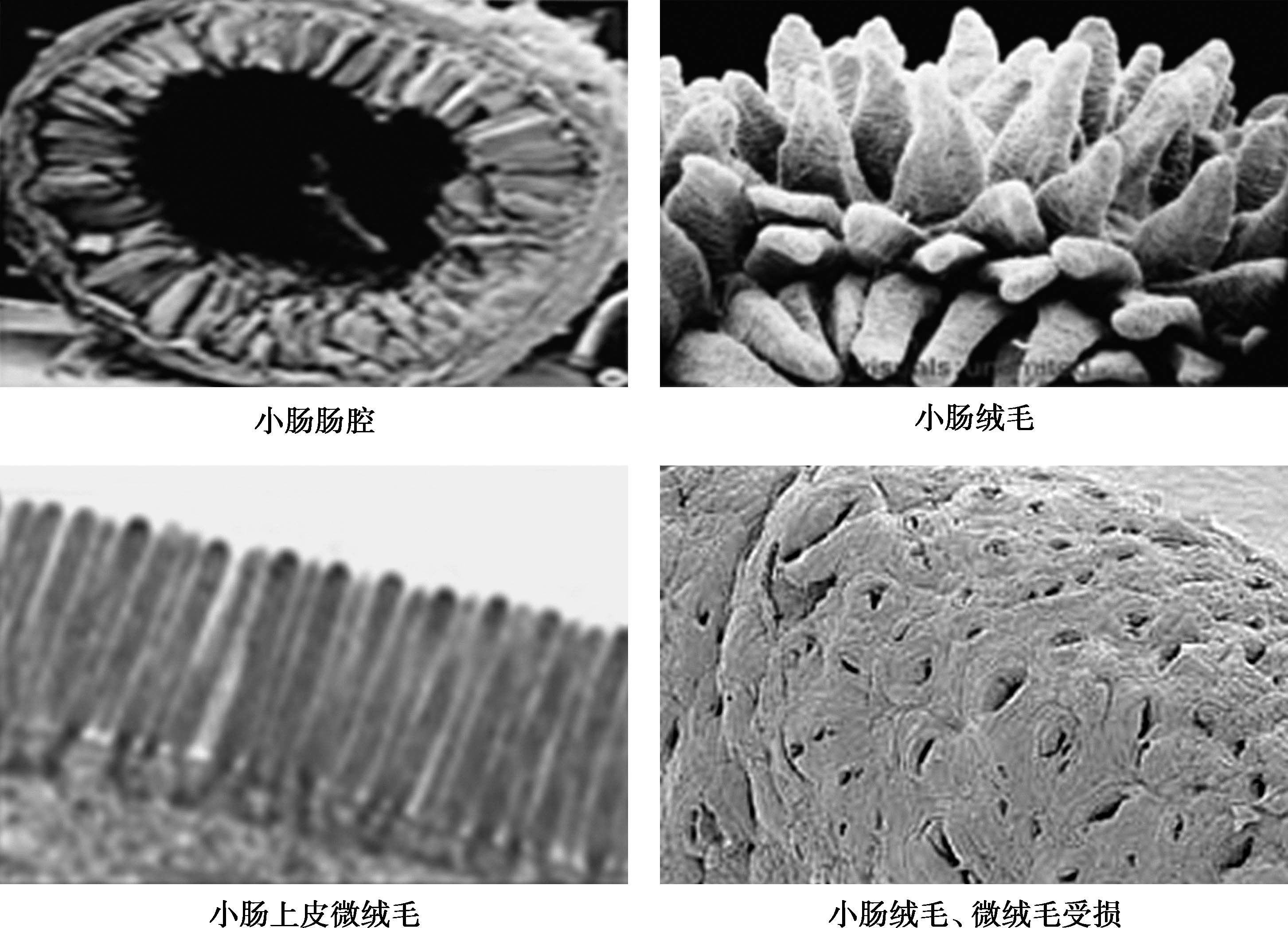 图2-1 小肠绒毛结构图组图