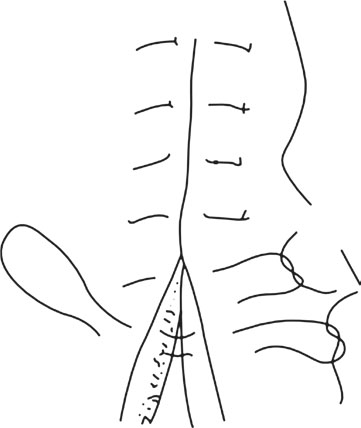 西医外科学(高职)最新章节_刘伟道著_掌阅小说网
