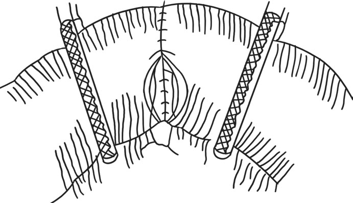 西医外科学(高职)最新章节_刘伟道著_掌阅小说网