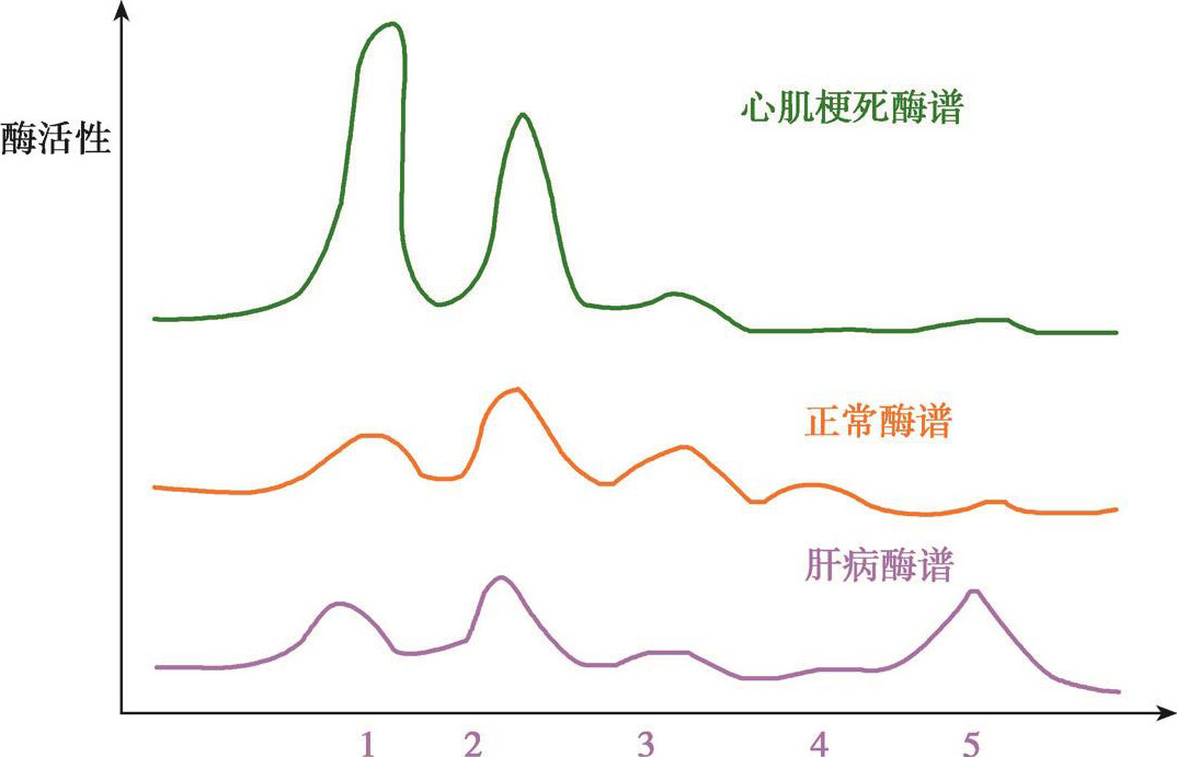 图4-19 心肌梗死和肝病患者血清ldh同工酶酶谱的变化