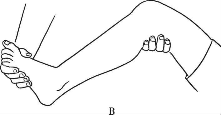 图3-17 阵挛(自绘图) a.髌阵挛;b.踝阵挛 2.浅反射 刺激皮肤、黏膜及